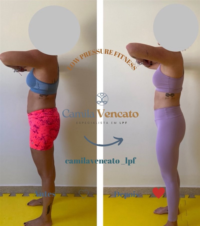 Antes e depois no torso, vista de lado, de uma aluna do Método LPF com Camila Vencato