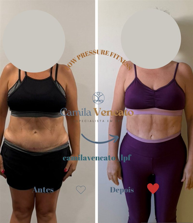 Antes e depois do corpo inteiro, vista de frente, de uma aluna do Método LPF com Camila Vencato
